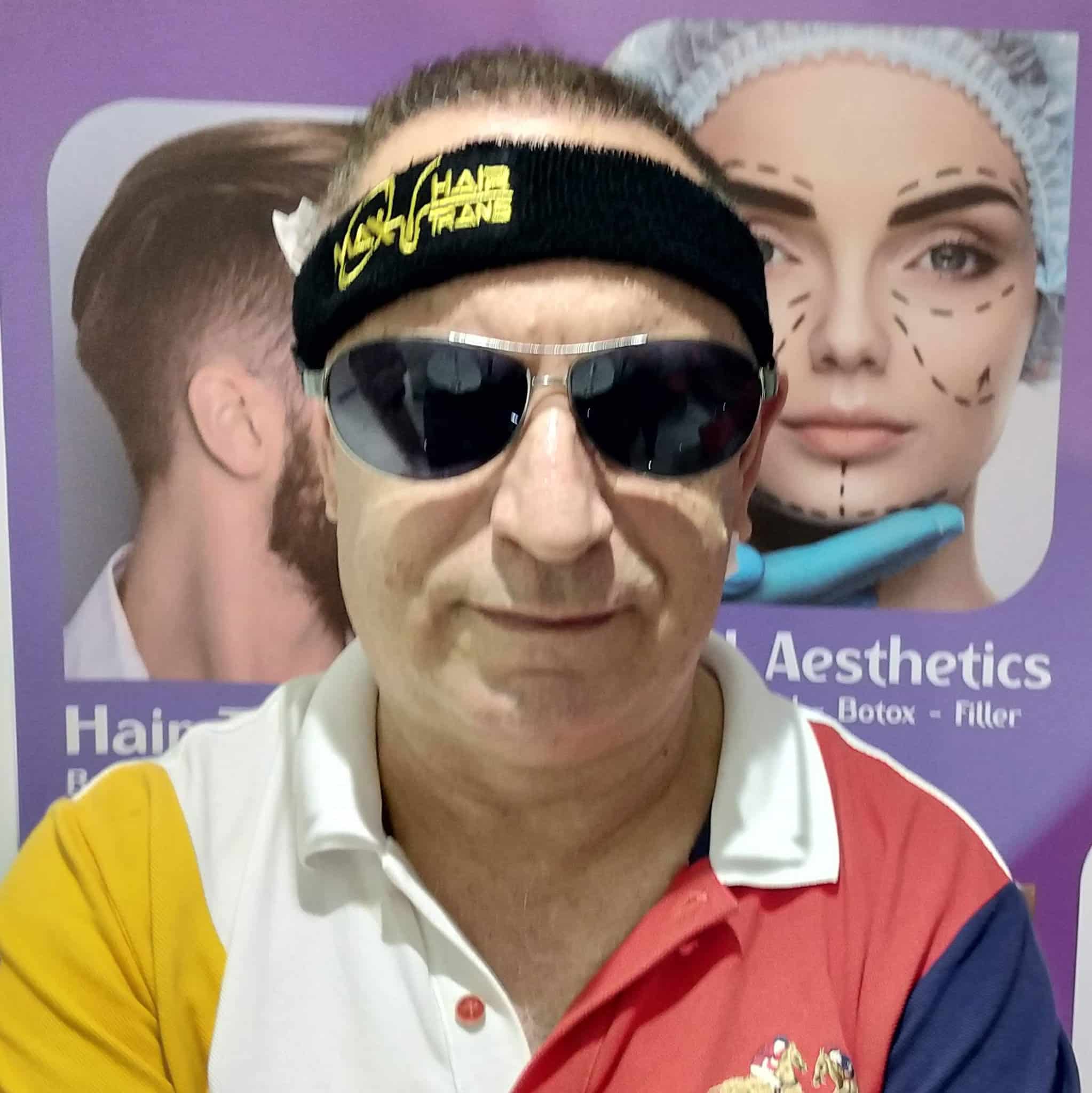 Hair Transplant Review